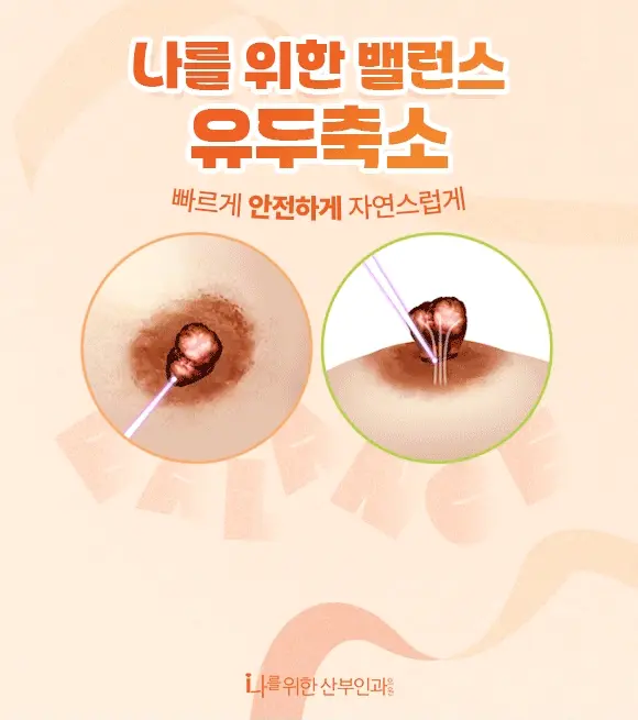 나를위한밸런스유두축소