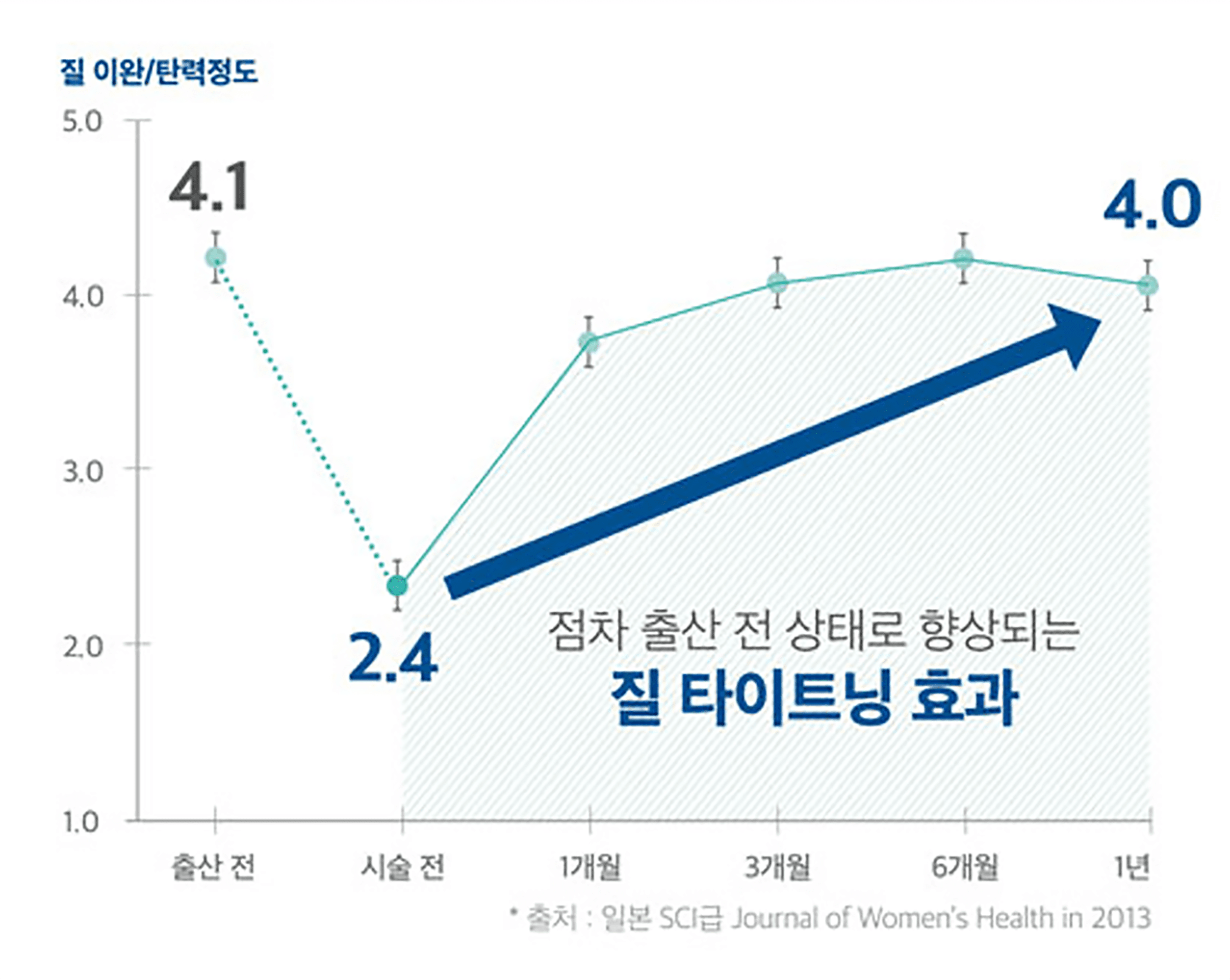 비비브 타이트닝 효과