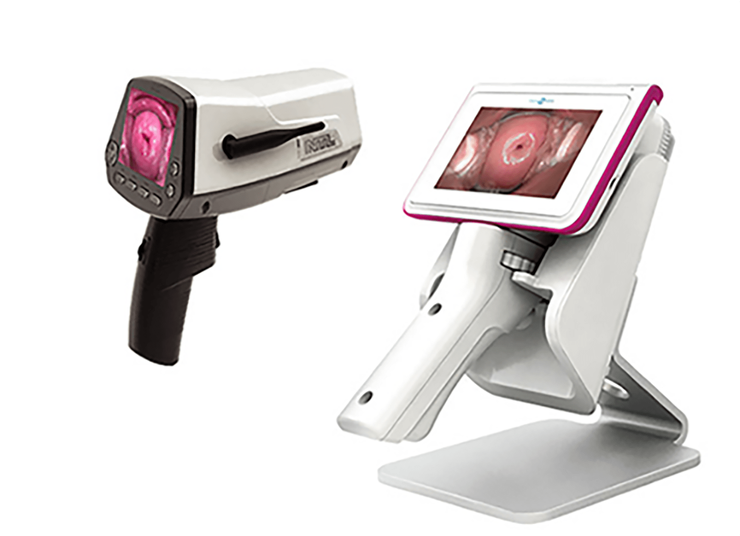 자궁경부암 텔레써비코 검사