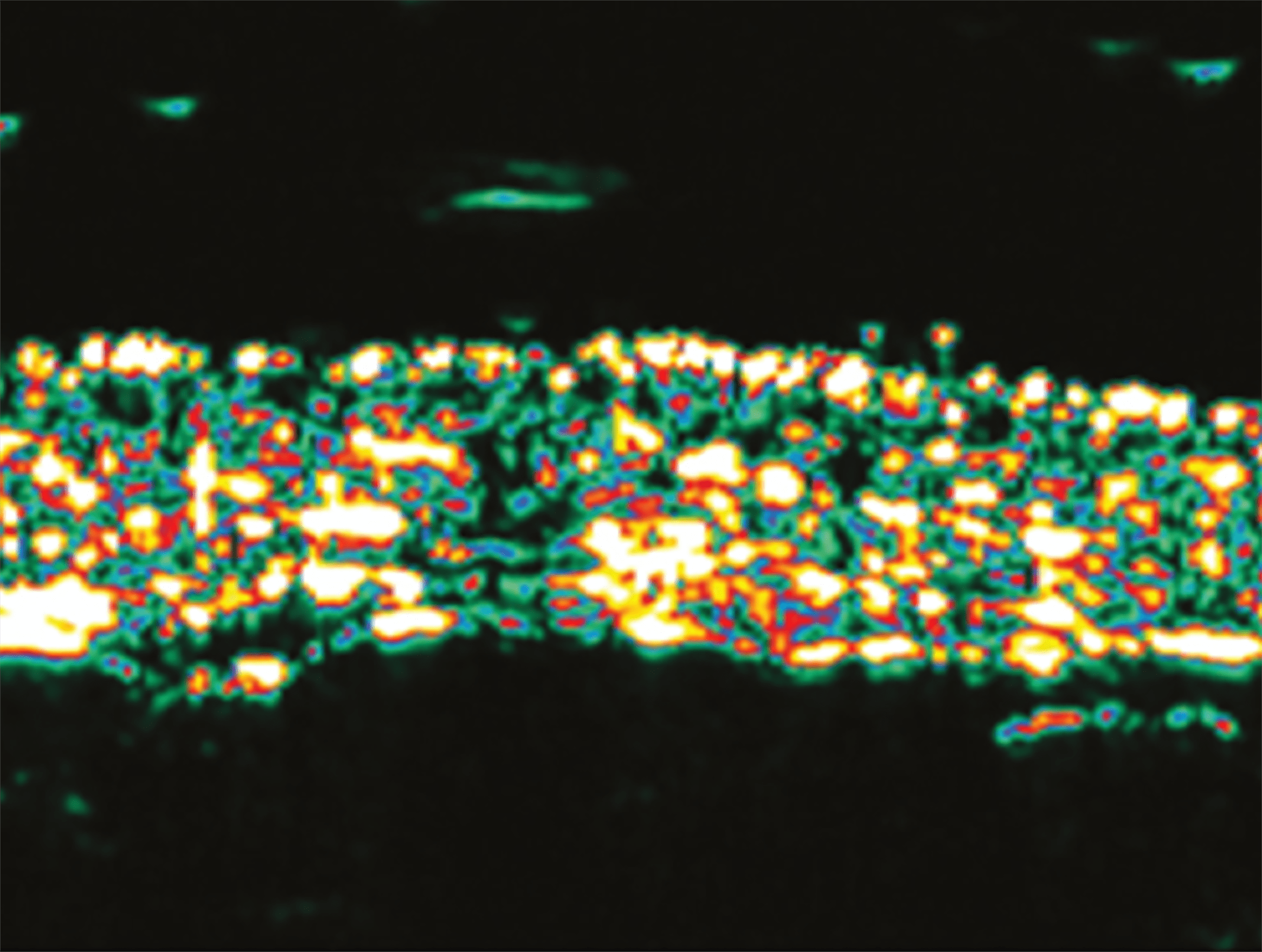 시술 후 피부 두께 34.19% 증가
