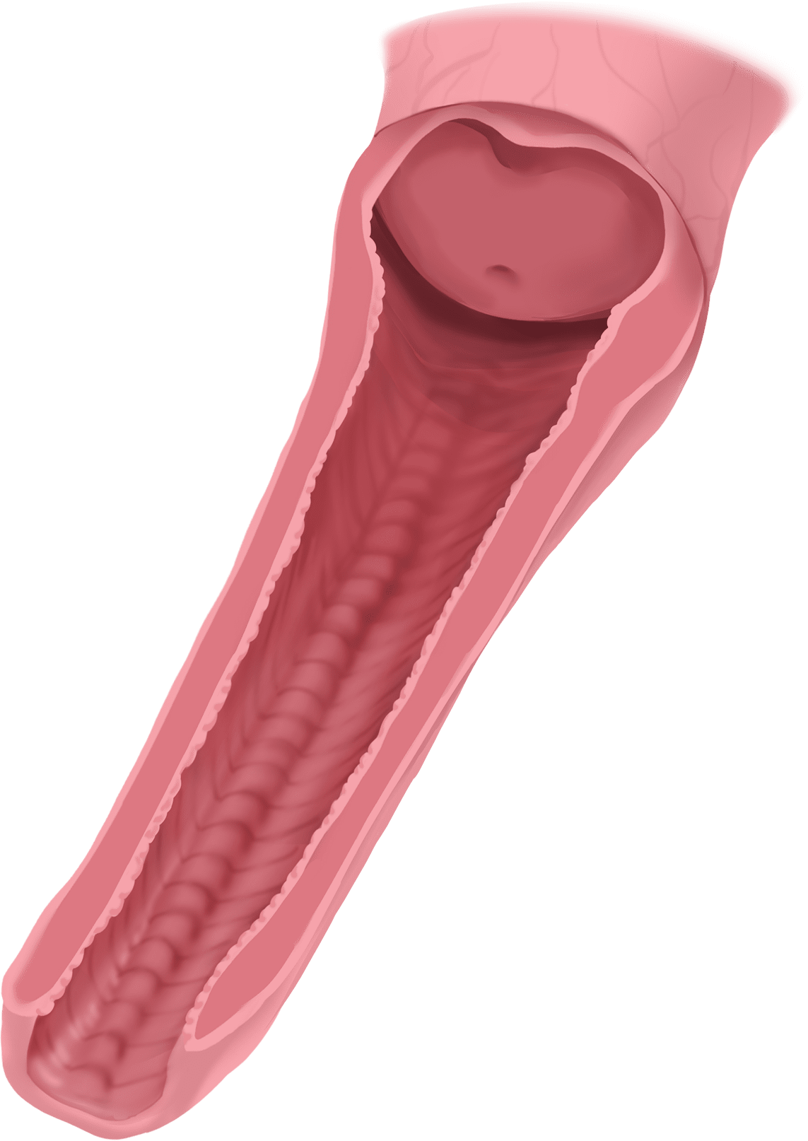 골반근육강화술