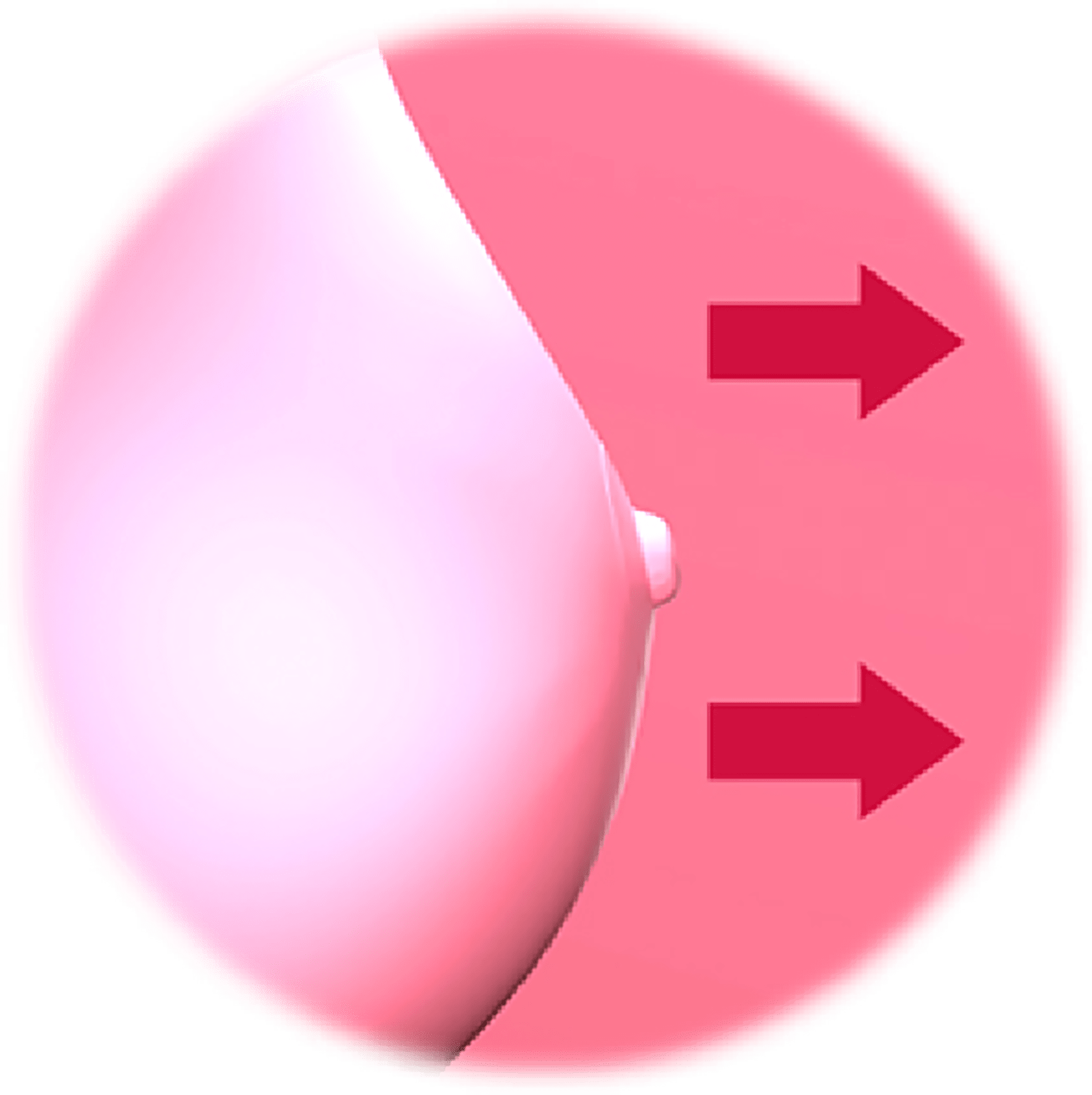 함몰유두의 종류